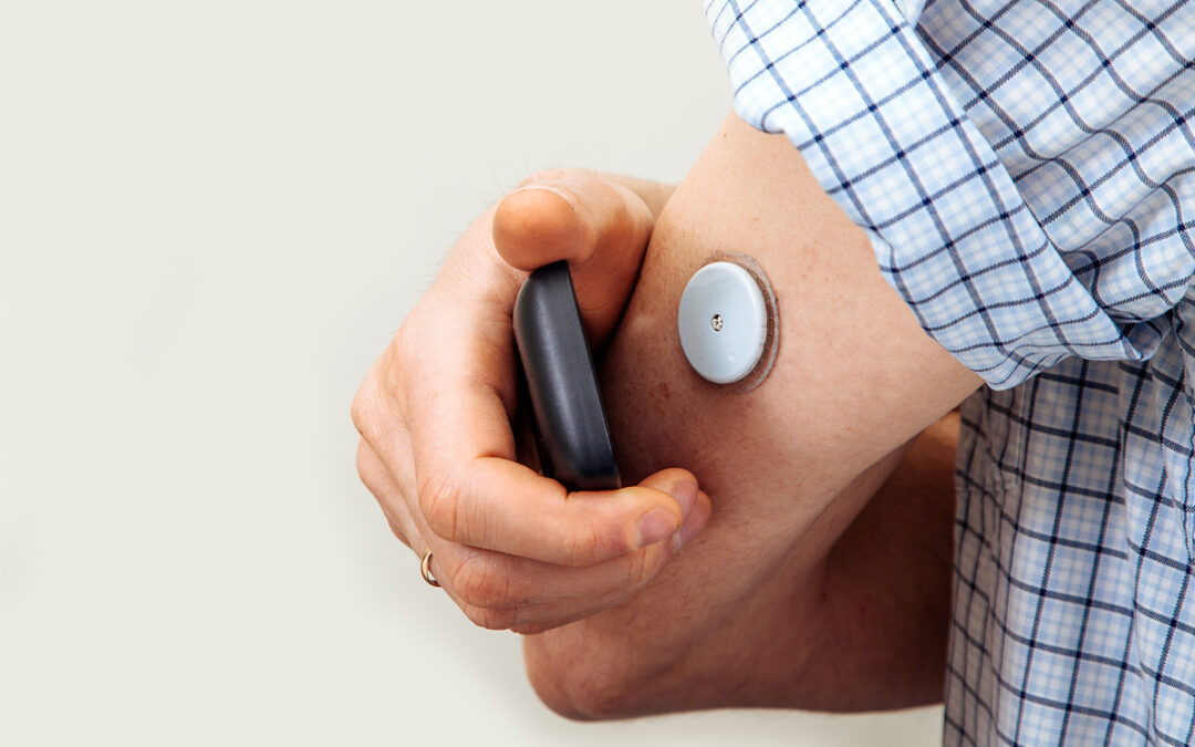 Monitores de Glucosa Cubiertos por Medicare: Lo Que los Pacientes Deben Saber