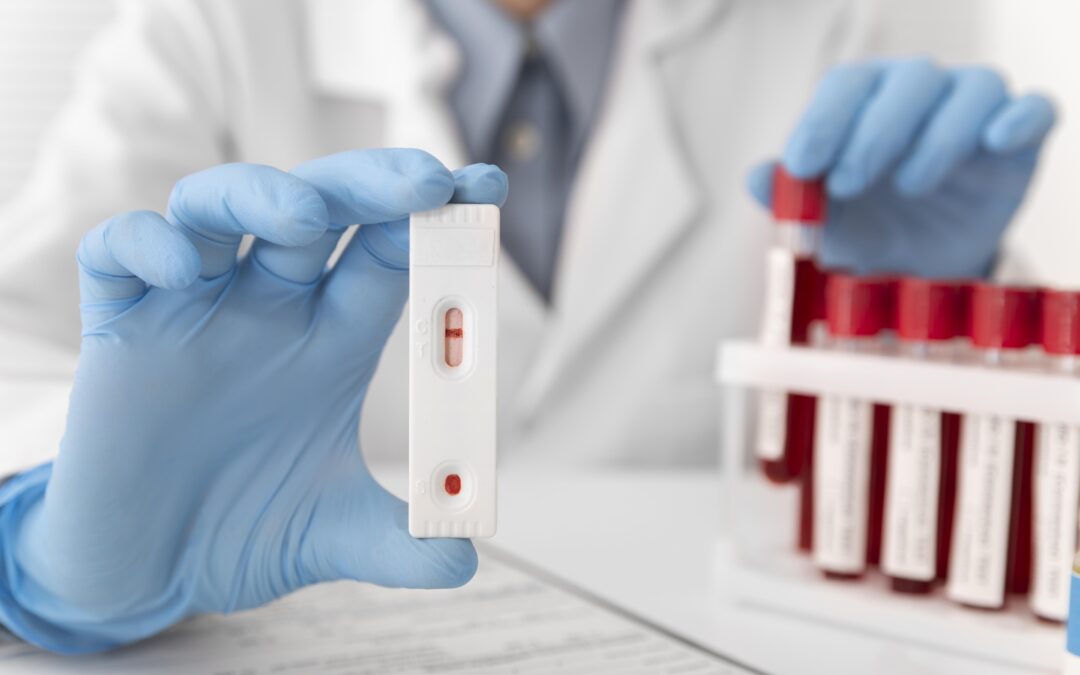 Ensayos Clínicos sobre el VIH: Avances en Tratamiento, Prevención y Esperanza