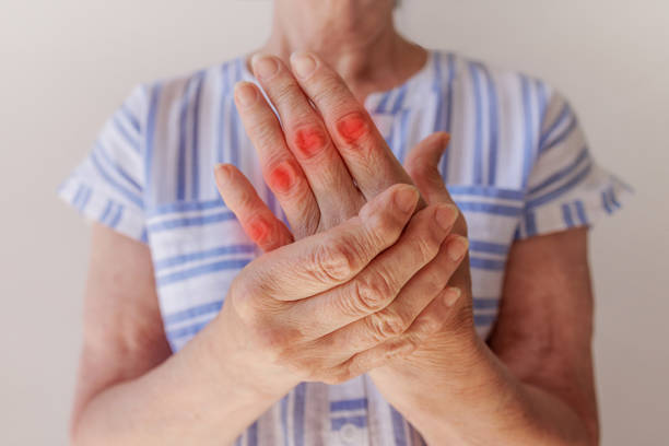 Arthritis Stem Cell Therapy Clinical Trials: What You Need to Know