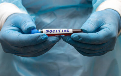 HIV Clinical Trials: Advancing Treatment, Prevention, and Hope